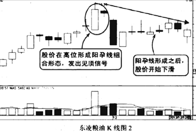 孕线