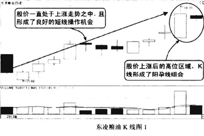 孕线